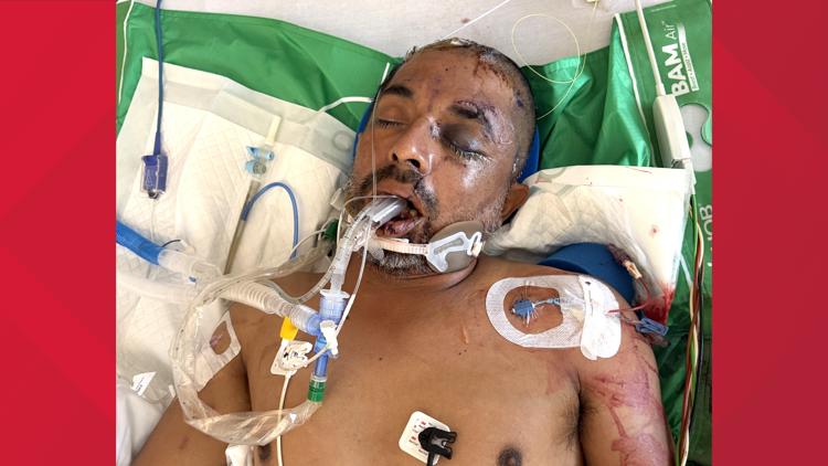 University Hospital asks for help identifying unconscious patient hit by truck Saturday evening — KENS 5 (San Antonio), Hopkins Health news
